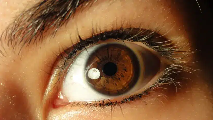 اعراض العين عند الاطفال
