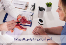 أعراض انغراس البويضة